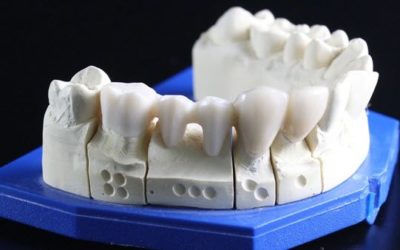 The Variations of Dental Crowns Offered in South Austin