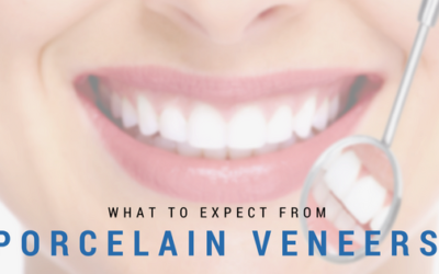 What You Can Expect From Getting Porcelain Veneers