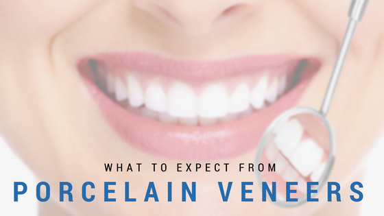 What You Can Expect From Getting Porcelain Veneers